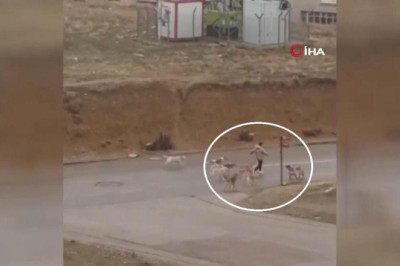 Ankara'da küçük çocuk köpek saldırısına uğradı