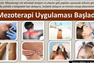 YALOVA EĞİTİM VE ARAŞTIRMA HASTANESİNDE MEZOTERAPİ UYGULAMASI BAŞLADI