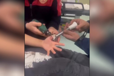 Parmağını Blendera Kaptırdı!