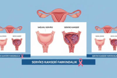 Yalova İl Sağlık Müdürlüğü’nden Serviks Kanseri İçin Ücretsiz Tarama Çağrısı