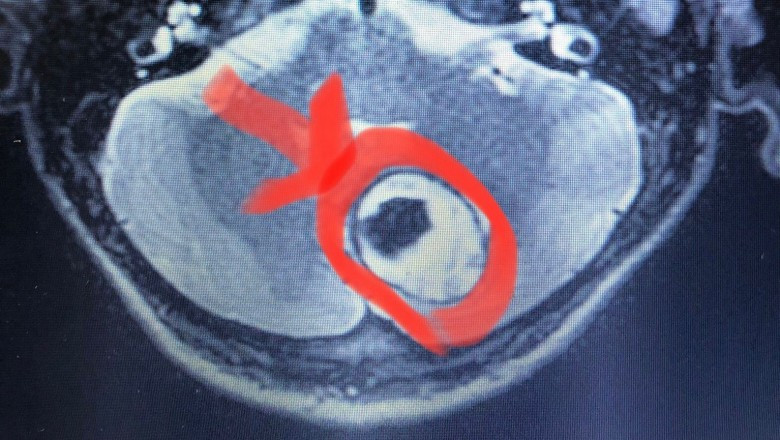 YALOVA DEVLET HASTANESİN'DEN BİR İLK DAHA