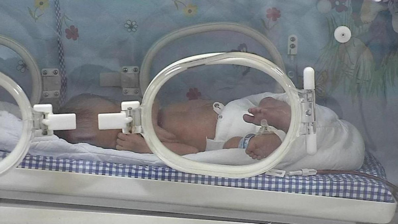 AYM'den kolu olmayan bebek kararı