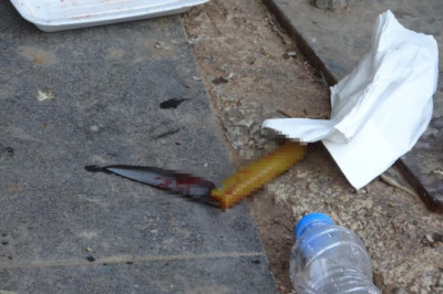Mersin'de bıçaklı kavgada 2 kişi yaralandı