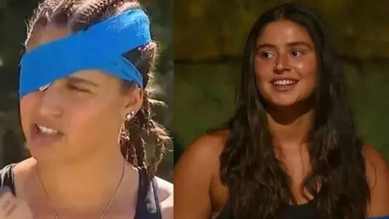 Acun Ilıcalı'dan üzen haber: Survivor Ayşe uzun bir süre yok! İşte Ayşe Yüksel'in sakatlık nedeni!