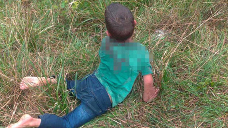 Yalova’da Sokak Köpeklerinin Saldırdığı Çocuk Ağır Yaralandı