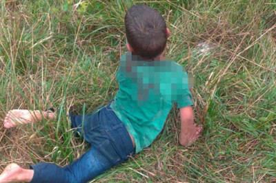 Yalova’da Sokak Köpeklerinin Saldırdığı Çocuk Ağır Yaralandı