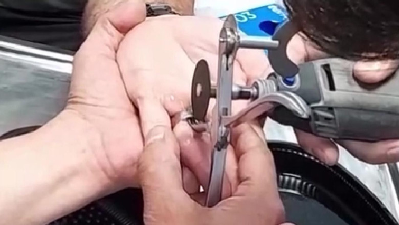 Vatandaşı Yüzük Kabusundan İtfaiye Kurtardı