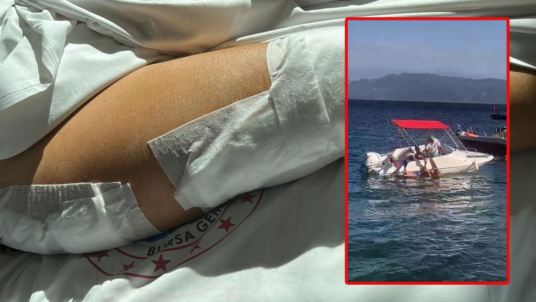 Yalova'da Sürat Teknesinin Çarptığı Yaşlı Kadın Ağır Yaralandı