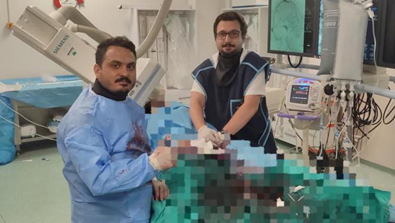 Yalova Üniversitesi Tıp Fakültesi’nden Bir İlk: Beyin Anevrizması Başarıyla Tedavi Edildi