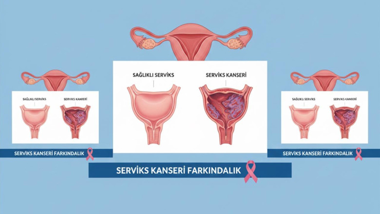 Yalova İl Sağlık Müdürlüğü’nden Serviks Kanseri İçin Ücretsiz Tarama Çağrısı