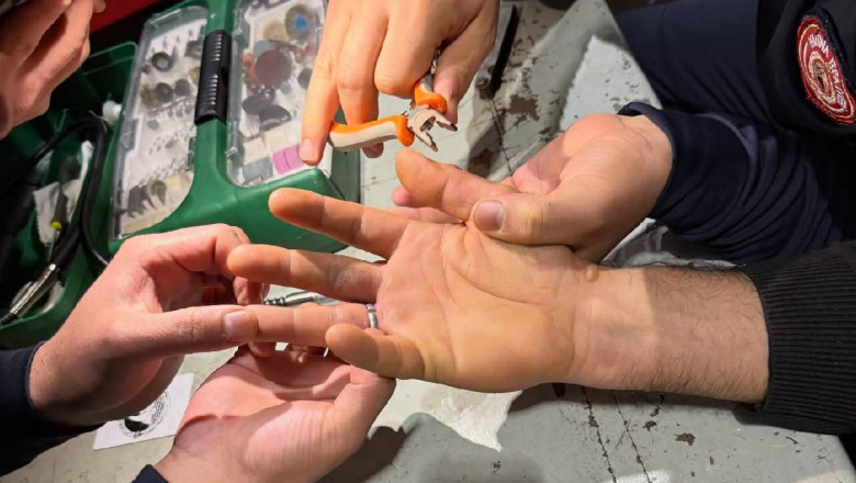 Gece Yarısı Panik: Parmağına Sıkışan Yüzük İtfaiye Tarafından Çıkarıldı